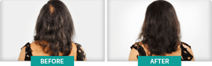 BioGrow RX Customer ~Lisa P.